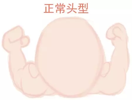 ԲͷվɱͷЩ趼֪1.webp.jpg