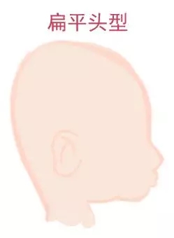ԲͷվɱͷЩ趼֪4.webp.jpg