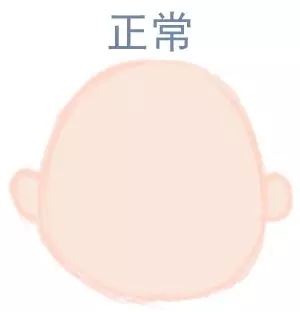 ԲͷվɱͷЩ趼֪5.webp.jpg